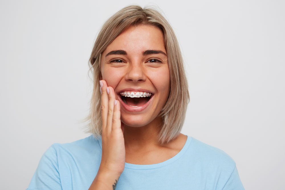 aparelho nos dentes