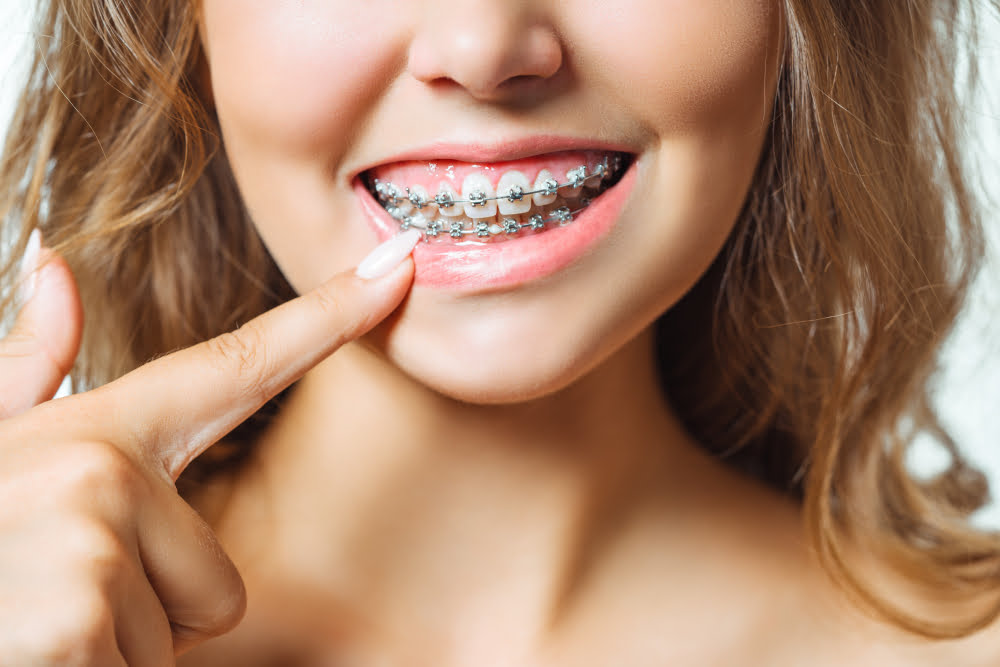 close up portrait young cheerful readhead woman orthodontist